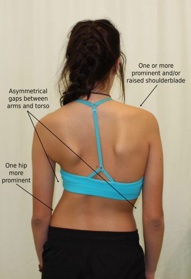 symptoms_back-scaled